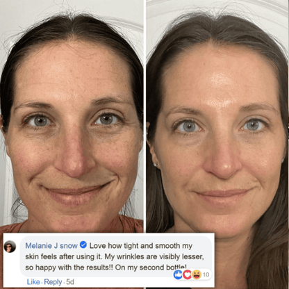 Arencie | Retinal Tightening Booster